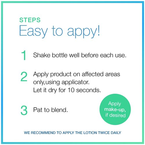 End-zit Acne Control Drying Lotion (Light/Medium), 0.5 Ounce