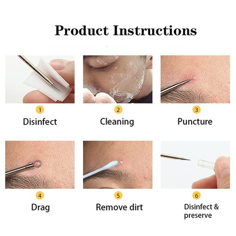 Blackhead Remover Pimple Popper Tool Kit,6 Pcs Acne Comedone Zit Blackhead Extractor Tool for Nose Face,Stainless Steel Whitehead Popping Removal Tool Set