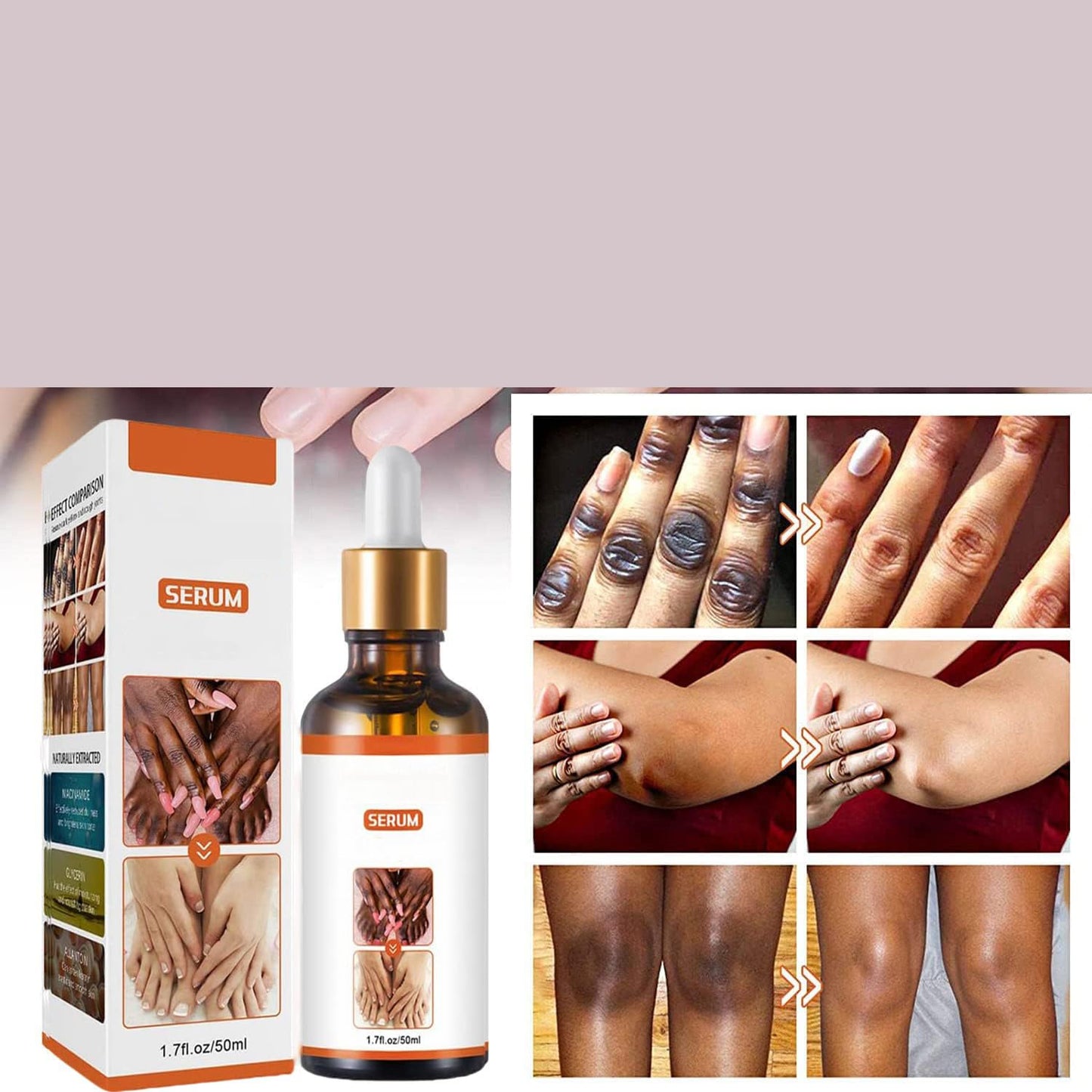 JASUBAI Body Moisturizing Serum for Dry Skin, Nourishing for Elbows, Knees and Fingers