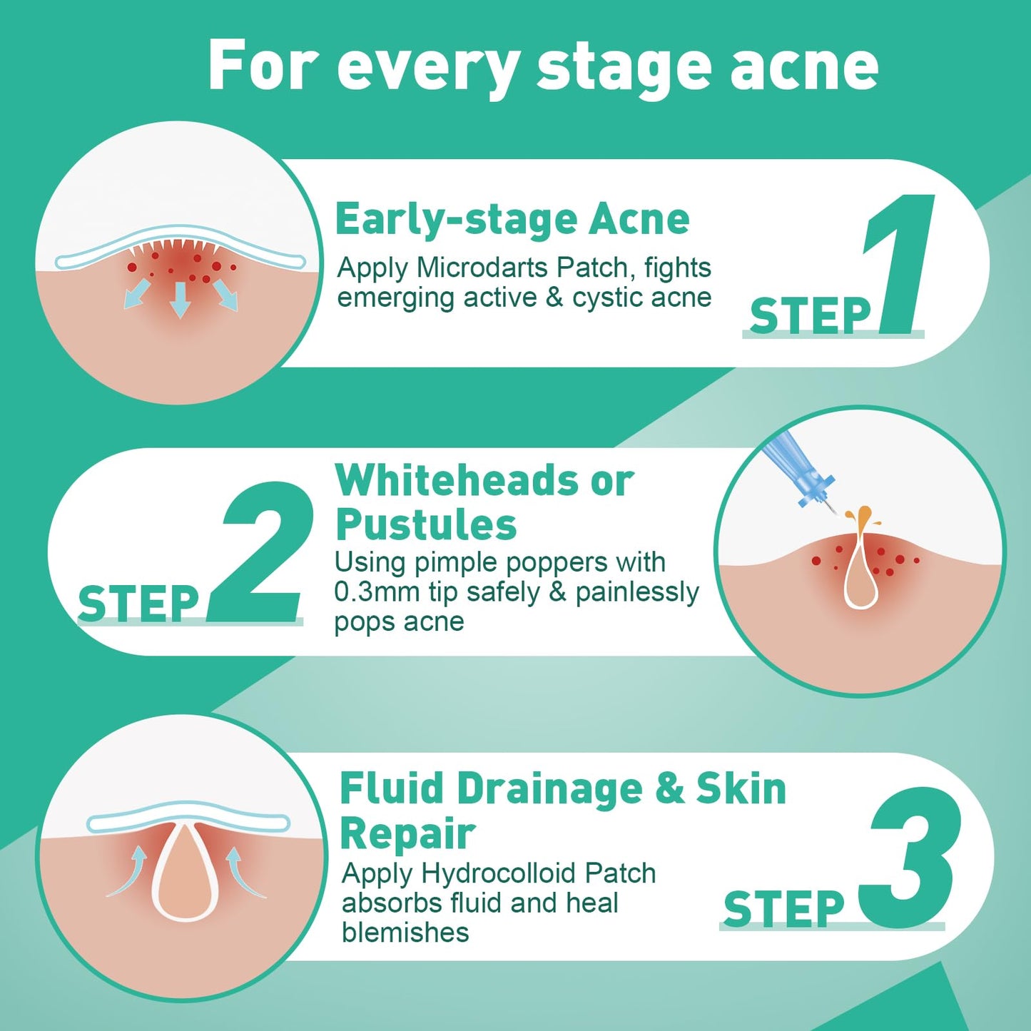 3-Step Microdart Pimple Patches Set – 83 Count, including 9 Microdarts Pimple Patches, 50 Pimple Poppers, and 24 Hydrocolloid Patches