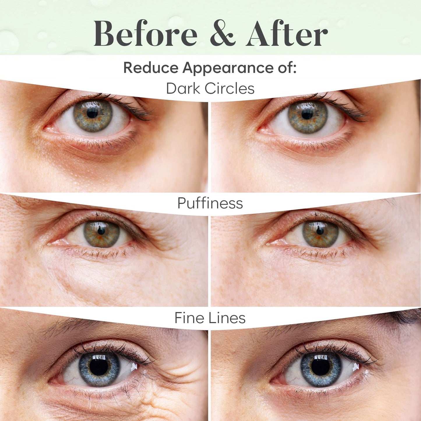BLOOMORA Green Tea Under Eye Patches (20 Pairs) - Dark Circles & Puffiness Care - Hydrating Eye Mask for Dark Circles and Puffiness