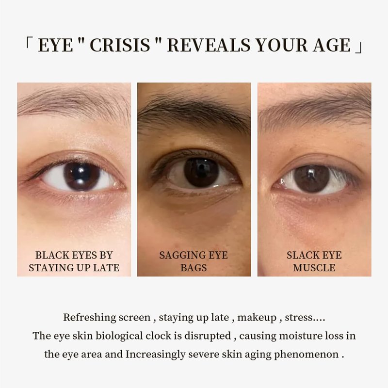 Eye Cream for Dark Circles - Anti-Aging Treatment with VA, VC & VE | Firming & Hydrating, 30g/1oz