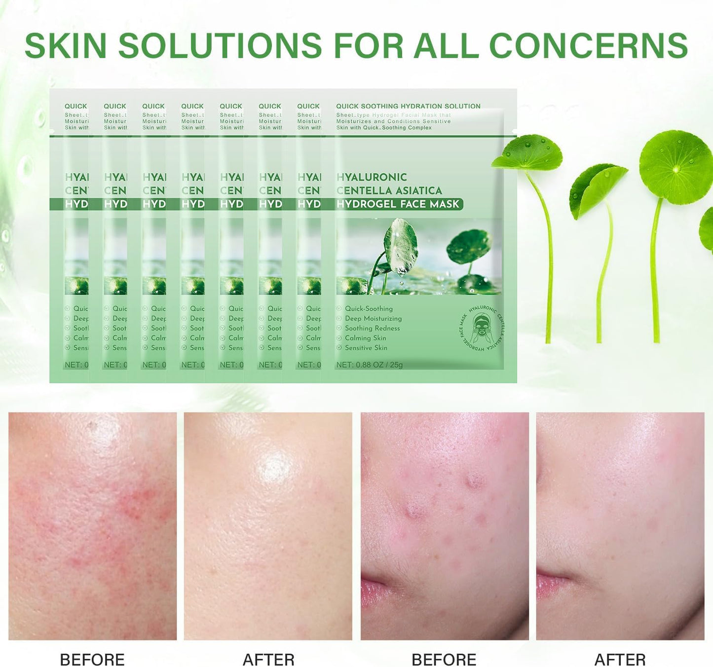 Calming Mask for Face, Centella Asiatica Calming Mask, Facial Masks with Aloe Hyaluronic Acid for Sensitive Skin,Soothing,Anti Aging Face Mask,Face Masks Skincare,Hydrating Sheet Facial Masks 10 pack