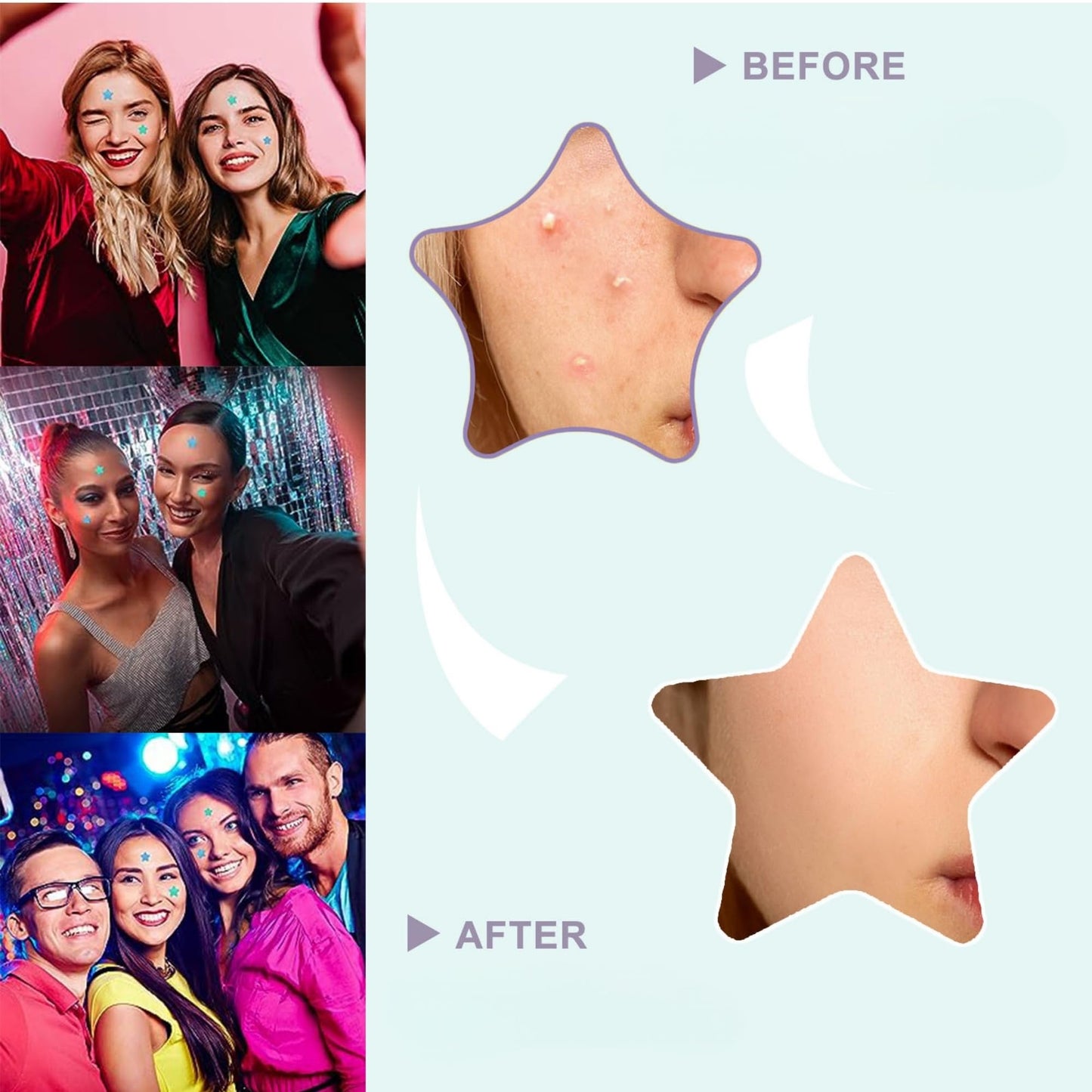 viviyoo 560 Pcs Star Pimple Patches for Face, 7 Colors Hydrocolloid Acne Patches, Cute Zit Patches for Blemishes & Zits, Vegan & Cruelty-Free Star Face Stickers for Girls & Teens (14 Sheets)