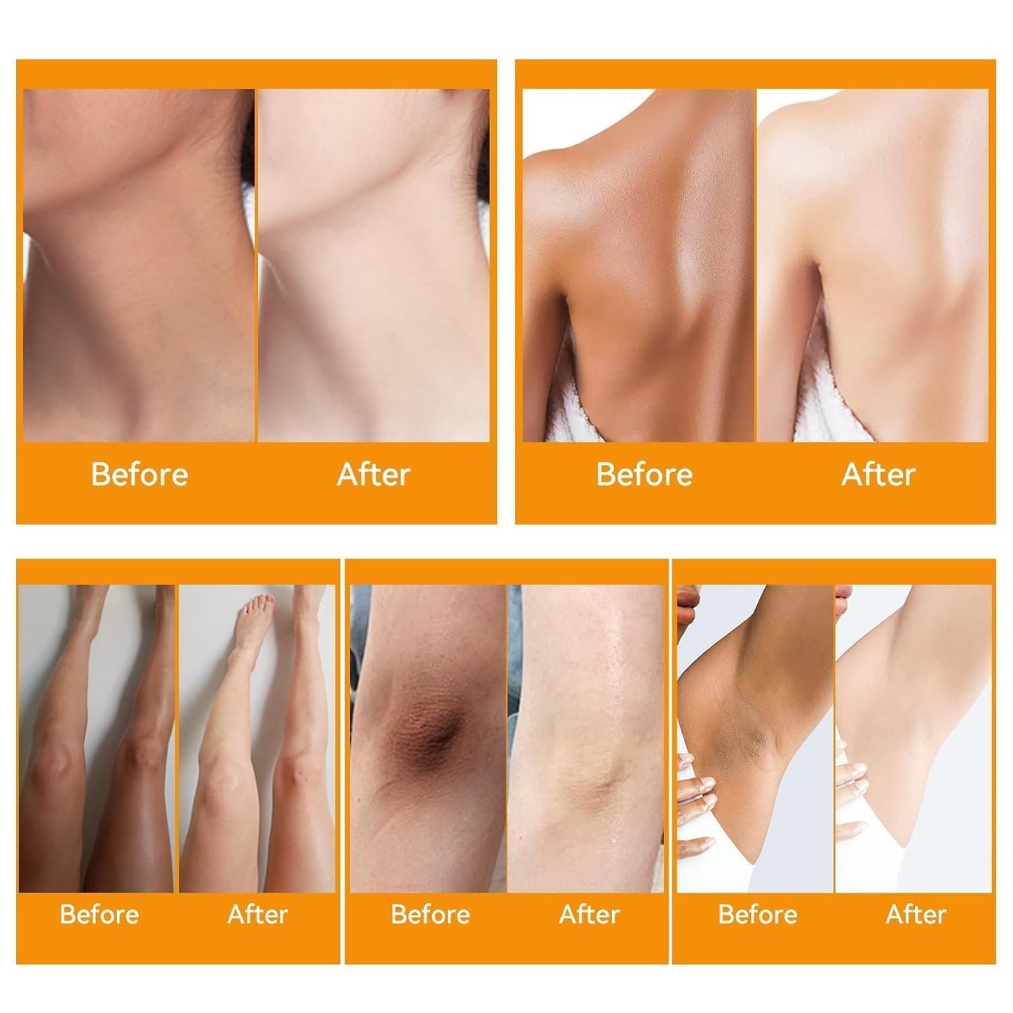 Dark Elbow and Knees Remover, Skin Brightening Cream for Dark Inner Thigh