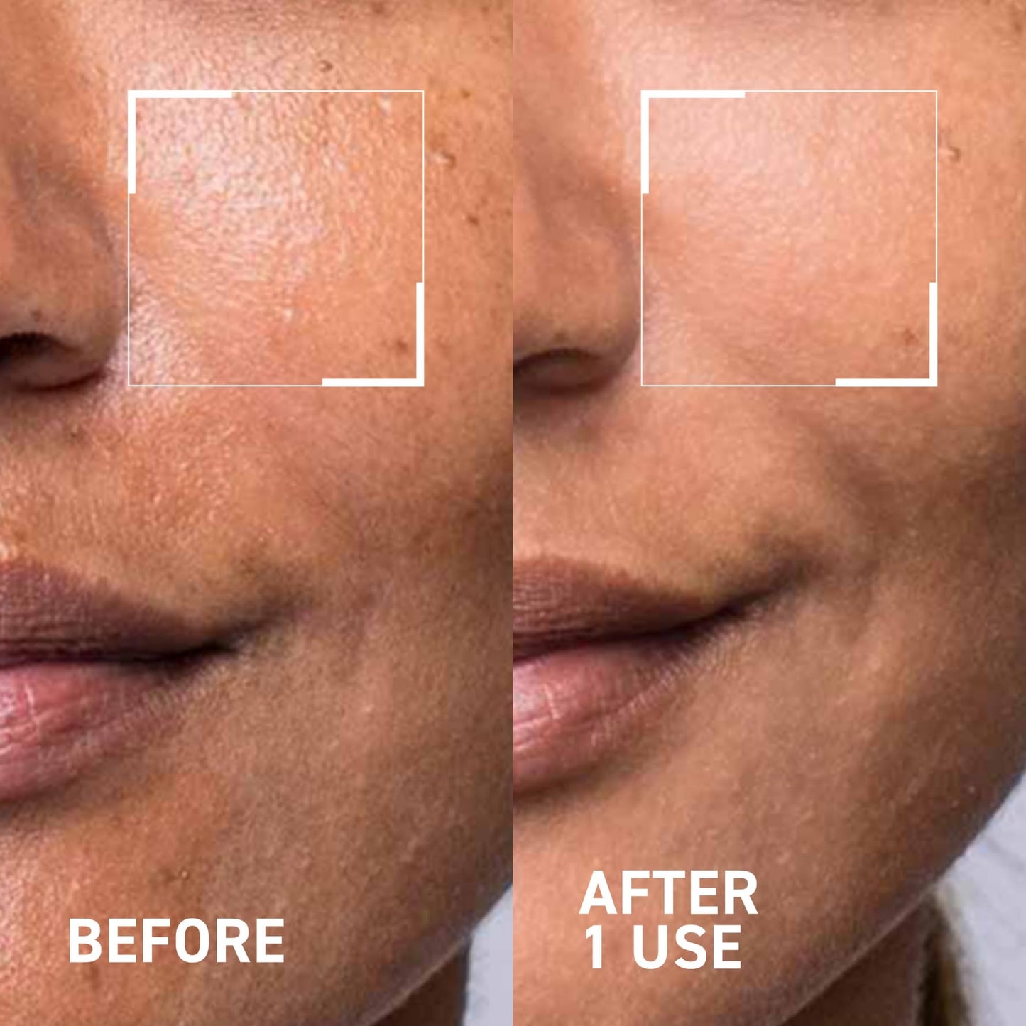 Dr. Brandt Pore Cleansing Duo - Includes Pores No More Purifying Cleanser (4.2 fl oz) + Gentle Microdermabrasion Face Exfoliator (2 oz)