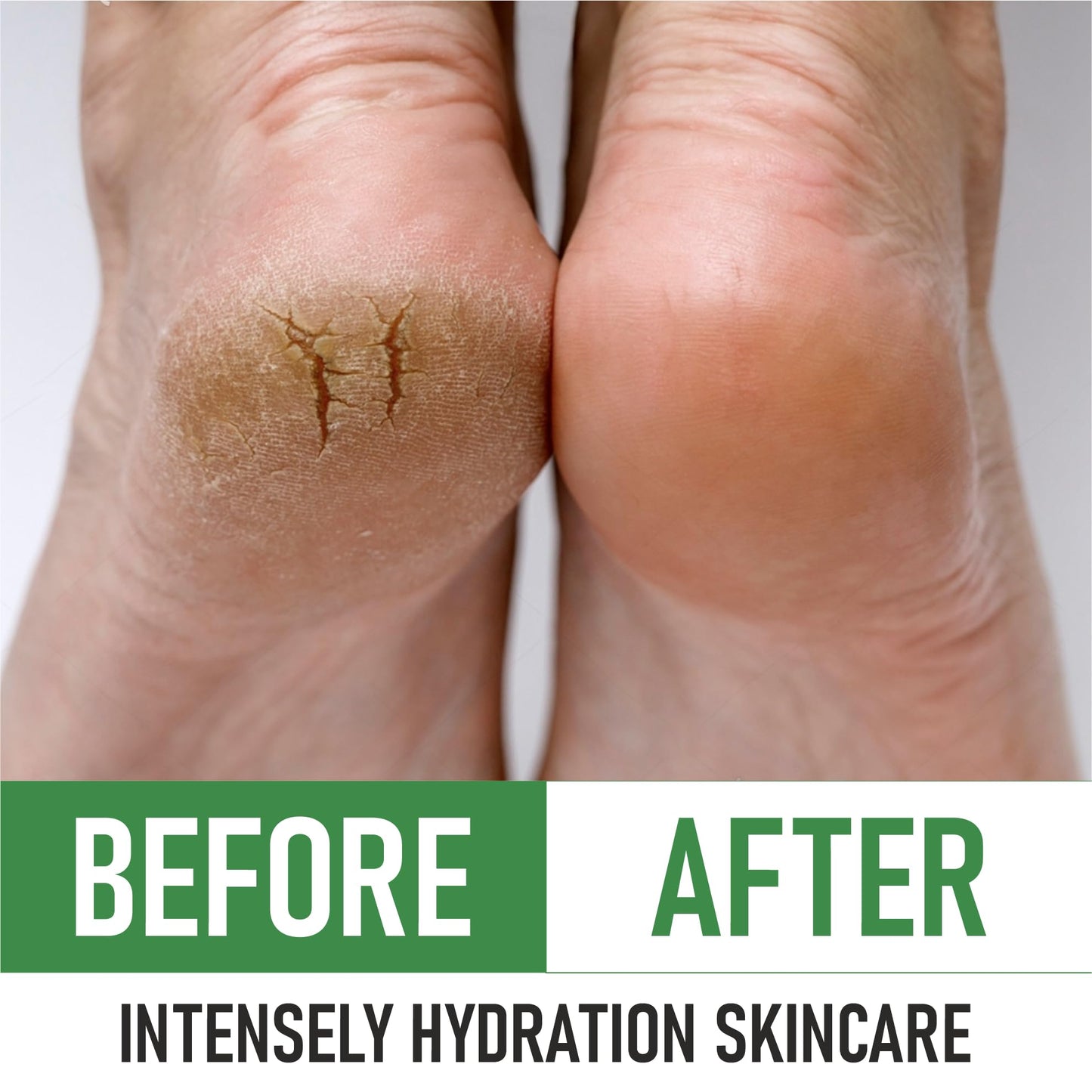 PurOrganica Urea Cream 40% – Made in USA, Maximum Strength Foot Cream for Dry, Cracked Heels, Corns, Calluses & Rough Feet, Exfoliating Moisturizer