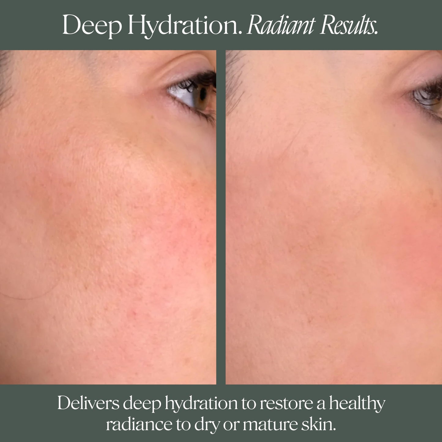 Doctor Rogers Face Cream for Intense Hydration, Anti-Aging Moisturizing Lotion to Reduce Fine