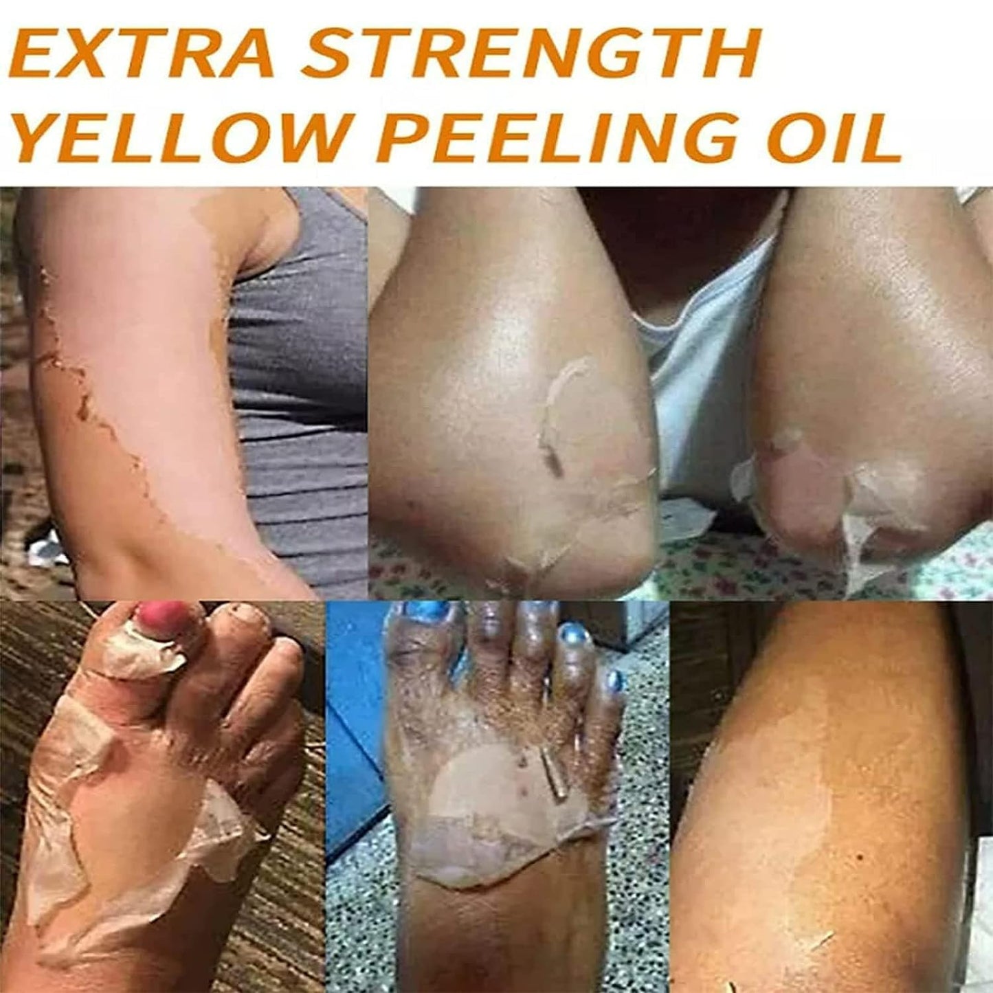 Yellow Peeling Oil, Peeling Oil for Dark Skin
