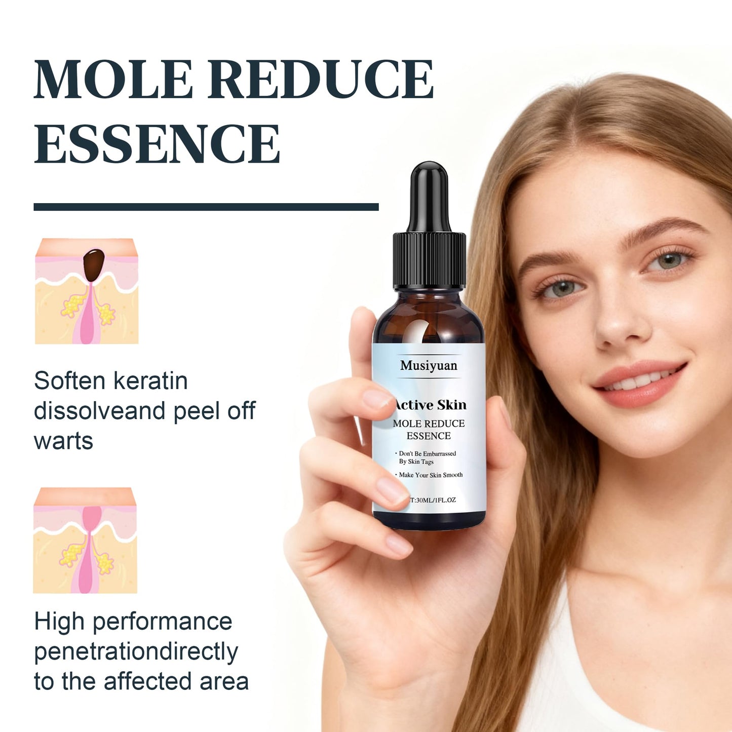 Musiyuan Facial and body mole and skin growth removal serum – fast-acting, precise dropper design effectively removes various warts (30ml)