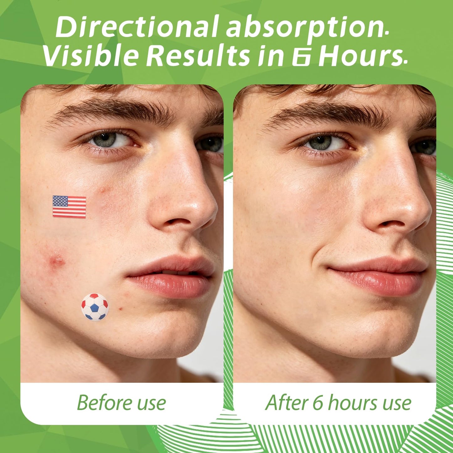 Anchiray American Flag & Soccer Design Hydrocolloid Pimple Patches for Face - Fun USA Face Patches for Game Day, World Cup & Party - Camouflages Blemishes, Absorbs Acne Overnight, 80 Counts