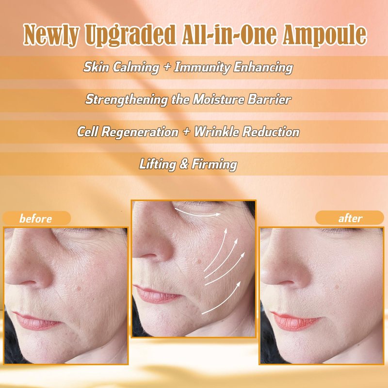 Exosomes Skin Collagen Serum,Hyaluronic Acid Serum propolis,ALA Concentrate ampoules For Anti-Aging, Microneedling, Skin-Firming Focused management of sebaceous absorption Instant Face and Eye Lift
