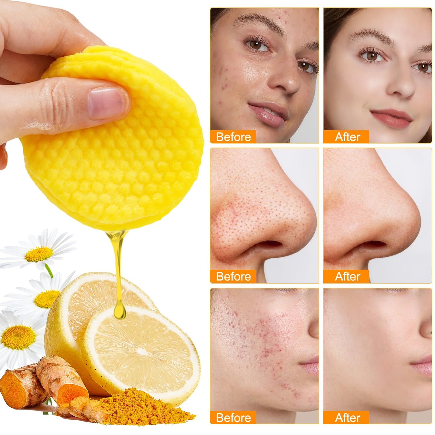 Turmeric Kojic Acid Vitamin C Exfoliating Pads - 50 Count for Oil Control, Hydration & Dullness Reduction - Face & Body Cleansing Pads