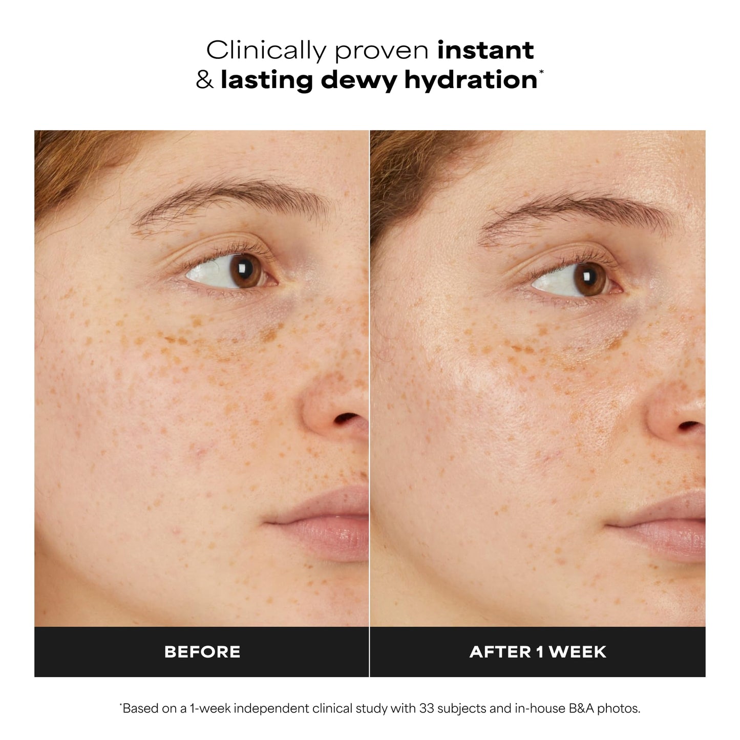 Paula's Choice 7% Ectoin + Hyaluronic Acid Hydrating Face Serum, 0.67 Fl Oz