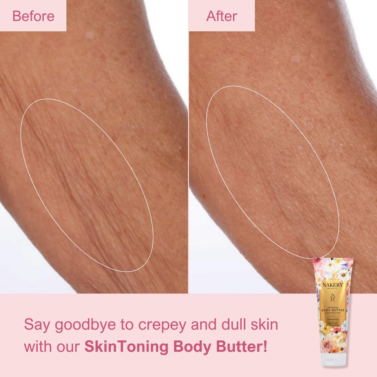 Nakery Skin Toning Body Butter for Women - Firming Body Lotion for Women - Peptide Infused Body Lotion for Crepey & Sagging Skin - Firming Lotion for Neck, Arms & Legs - Summer Petals