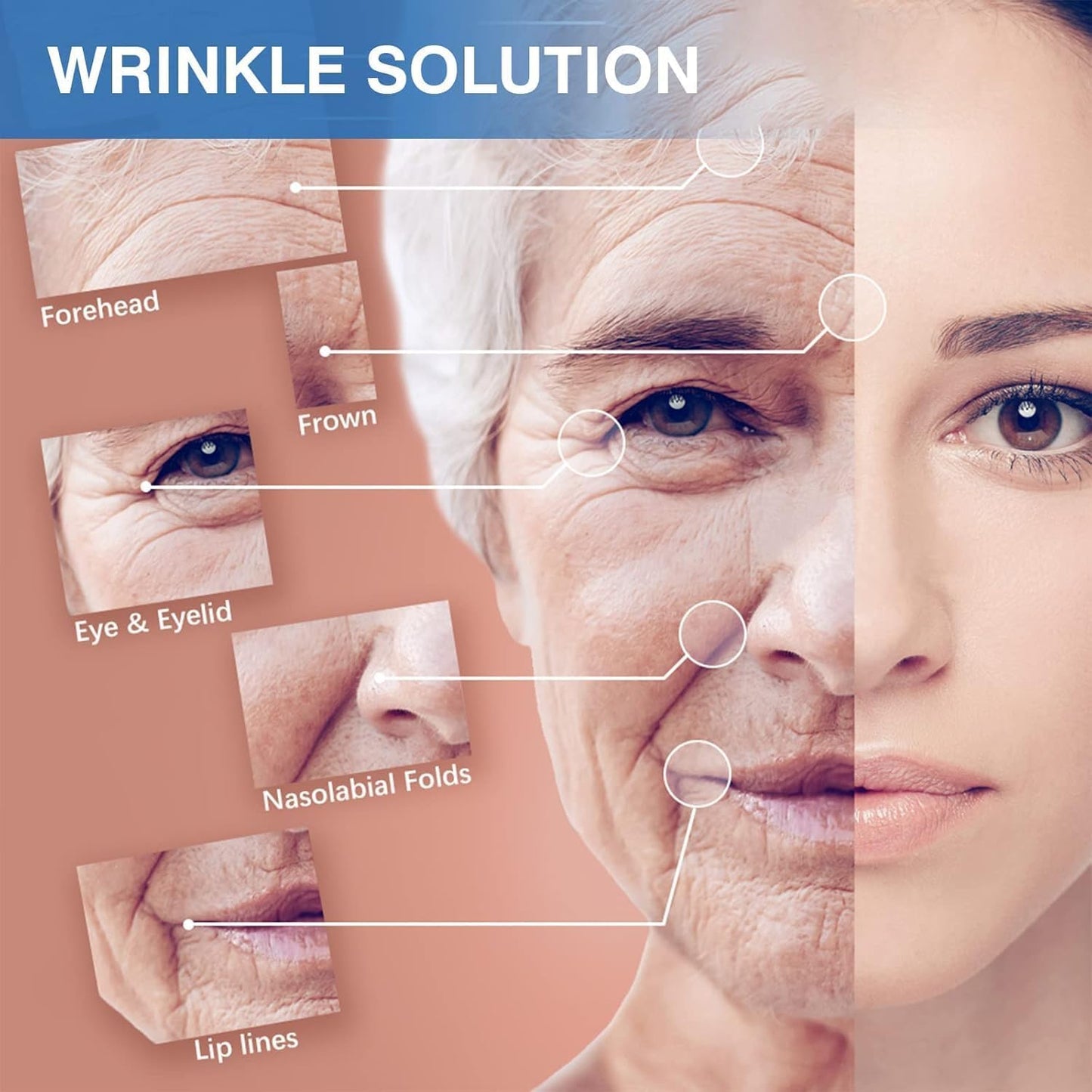 Sfuchin Facial Patches - Wrinkle Patches - Wrinkle Tape - Face Lifting Tape - Non-Invasive Wrinkle Remover - Multifunctional High Elasticity Wrinkle Forehead Eyes Face (Beige-2.5cm)