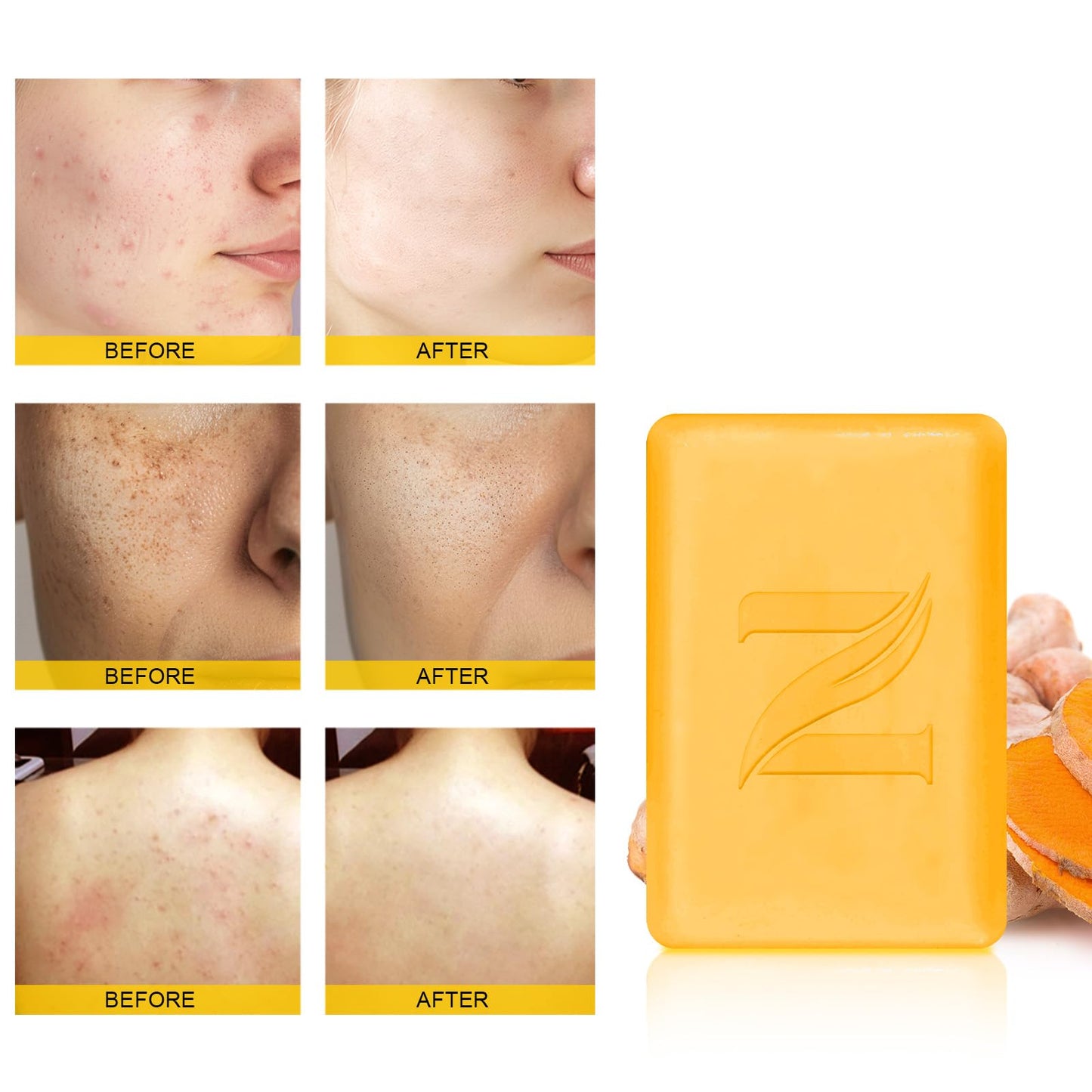 Neutriherbs Turmeric Soap for Face & Body(5.29 oz / 1 Bar),Brightening Vitamin C Soap Bar for Acne, Uneven Skin Tone, Cleansing Natural Soap