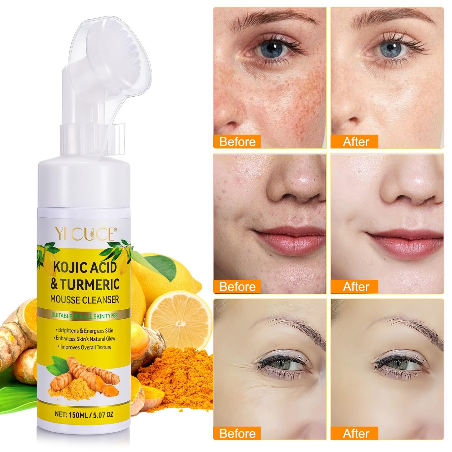 A r b c r n 2 Pack Turmeric Cleansing Mousse,Kojic Acid Facial Cleanser for Fce Wash and Firming Skin,Remove Excess Keratin-Deep Clean Pores 150ML
