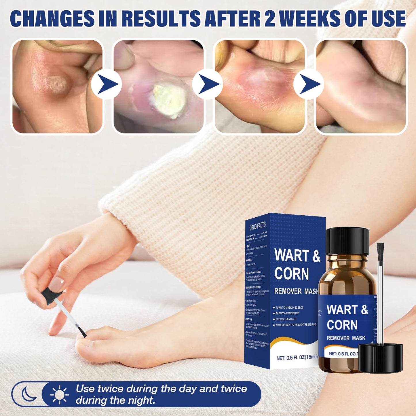 Wart Remover Liquid with Salicylic Acid for Feet and Hands, Plantar Wart and Corn Remover Freeze Off Formula, Fast Acting Treatment for Common Flat Warts, Corns and Calluses 15 ml (0.5 fl oz) 3 pack