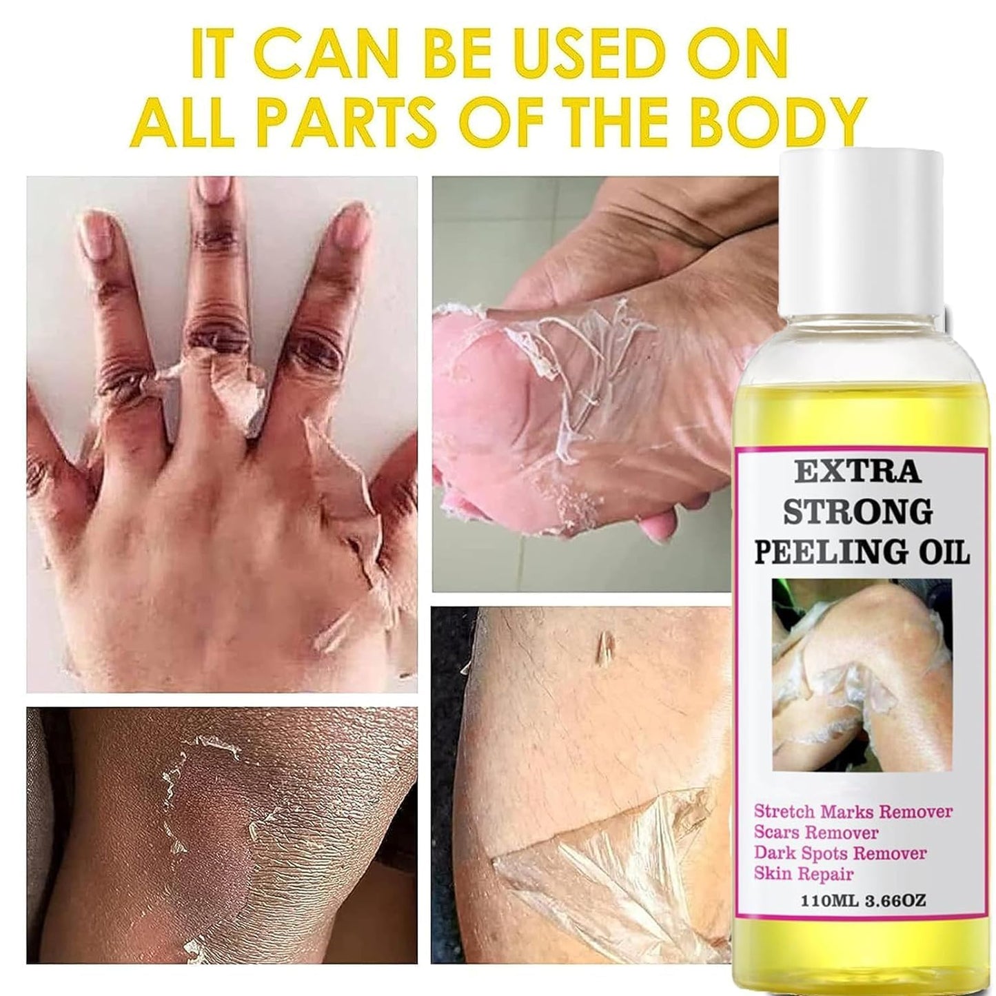 Generic Extra Strong Peeling Oil, Peeling Oil for Dark Skin, Yellow Peeling Oil, Exfoliating Peeling Solution for Hand Feet, Chemical Peel for Face, 110ML / 3.88 OZ (1 PCS)