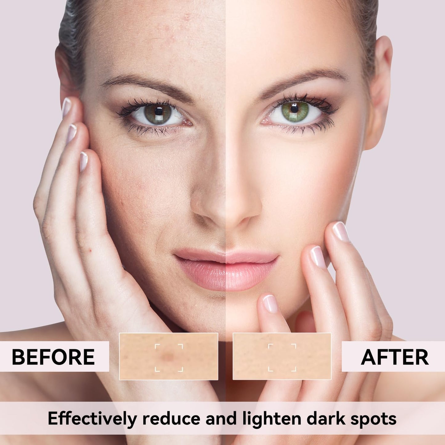 Dark Spot Remover for Face, Dark Spot Corrector for Age Spot Sun Spot Brown Spot Melasma Uneven Skin Tone, with Vitamin C and Hyaluronic Acid for Women and Men, 1.7 FL OZ