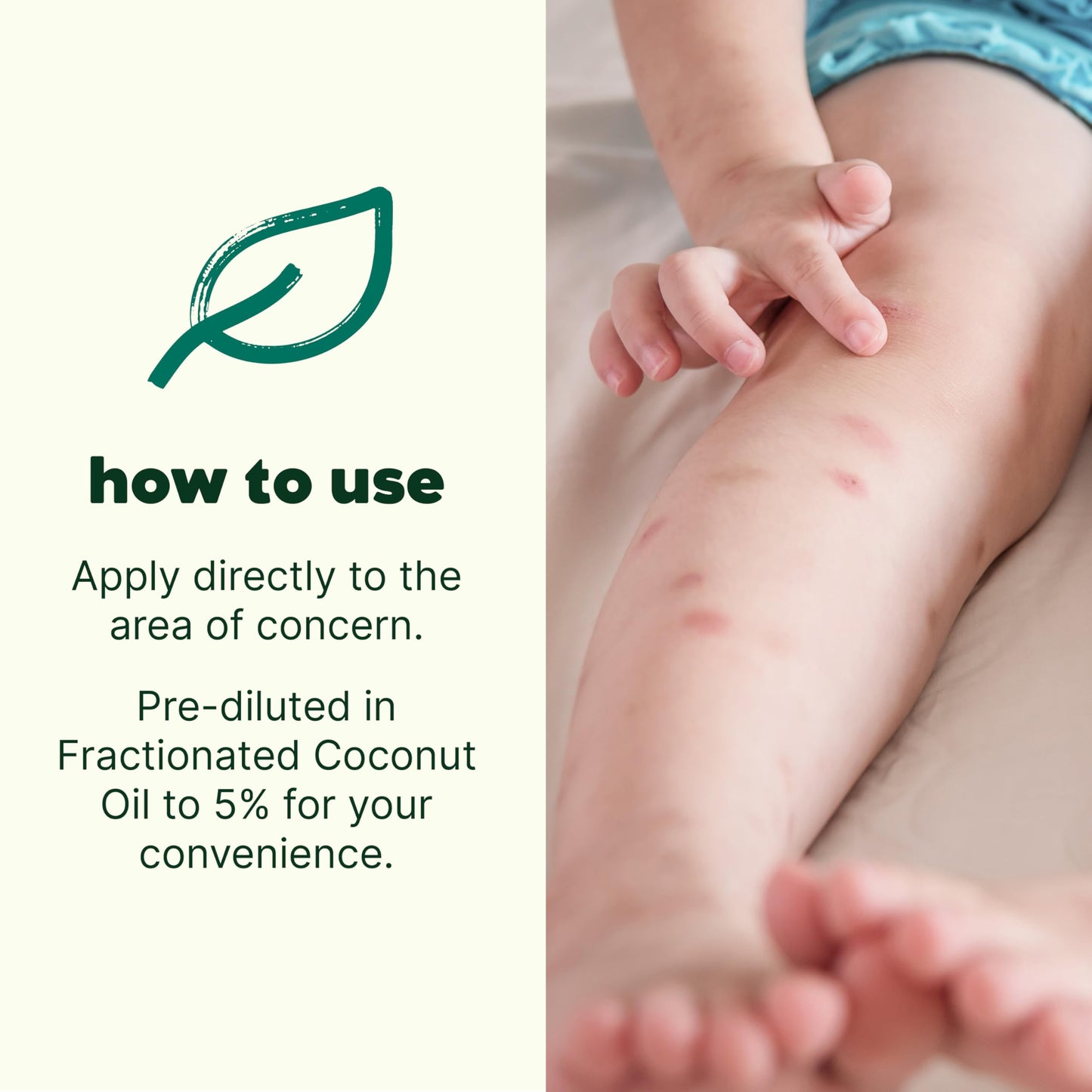 Plant Therapy Kids Itch Away Essential Oil Blend Pre-Diluted Roll-On 10 mL (1/3 oz) 100% Pure Essential Oils to Calm Itchy Skin, Redness, and Irritation