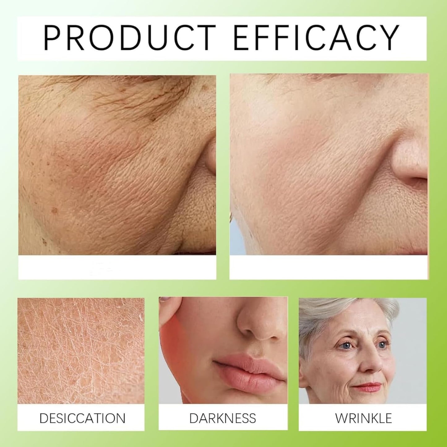 2Pcs Botoxmix & Vita-A Retinol Shot Wrinkle-Lift Tightening Cream, Vita-A Retinal Shot Tightening Booster for Wrinkles and Fine Lines, Retinol Shot for All Skin Types