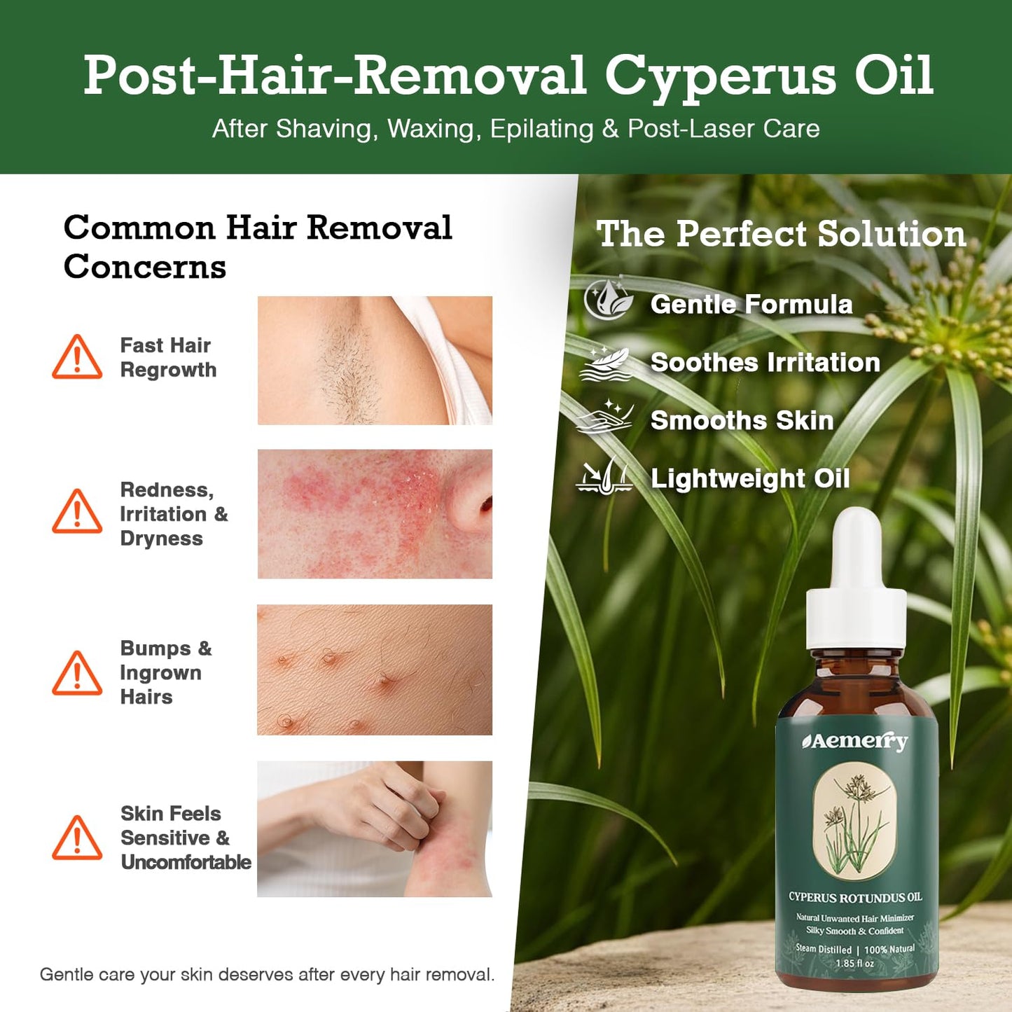 Cyperus Rotundus Oil: Natural Cyperus Rotundus After Hair Removal Oil, Slow & Reduce Regrowth for Face & Body, Moisturizing, Soothing & Smoothing Care, Safe for Sensitive Skin & PCOS.