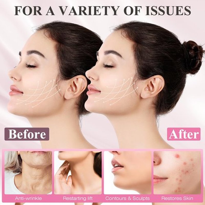 Chin Strap for Sleeping,Adjustable Chin Strap,Jaw Strap,Jawline Shaper,V Line Lifting Mask,Pink,M