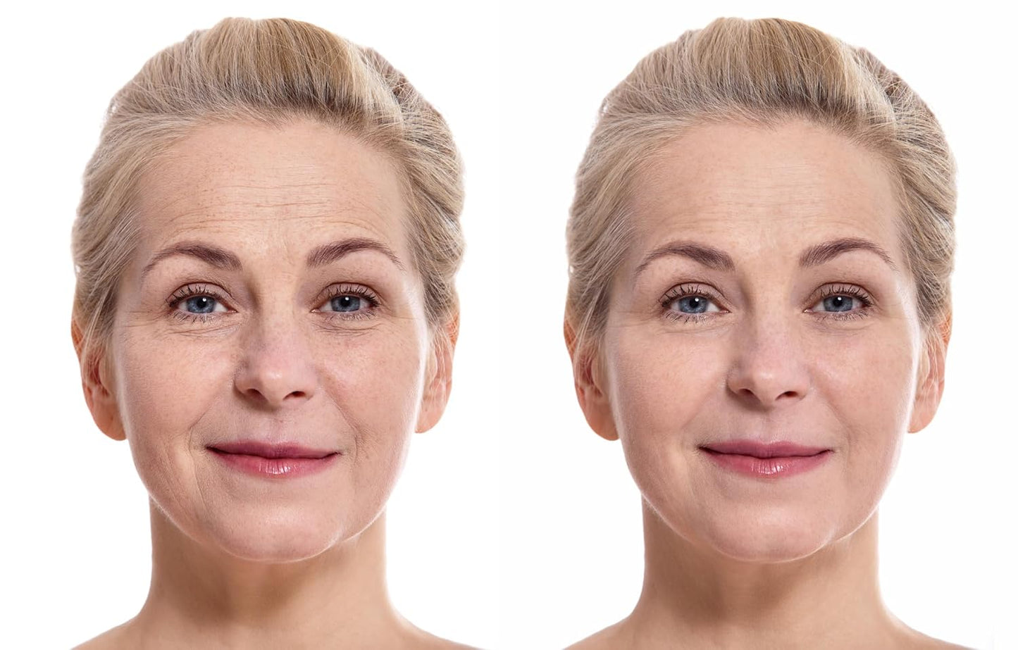Vitality Precision Skin Advanced AGE Interrupter Cream - Anti-Aging Moisturizer 1.6 oz