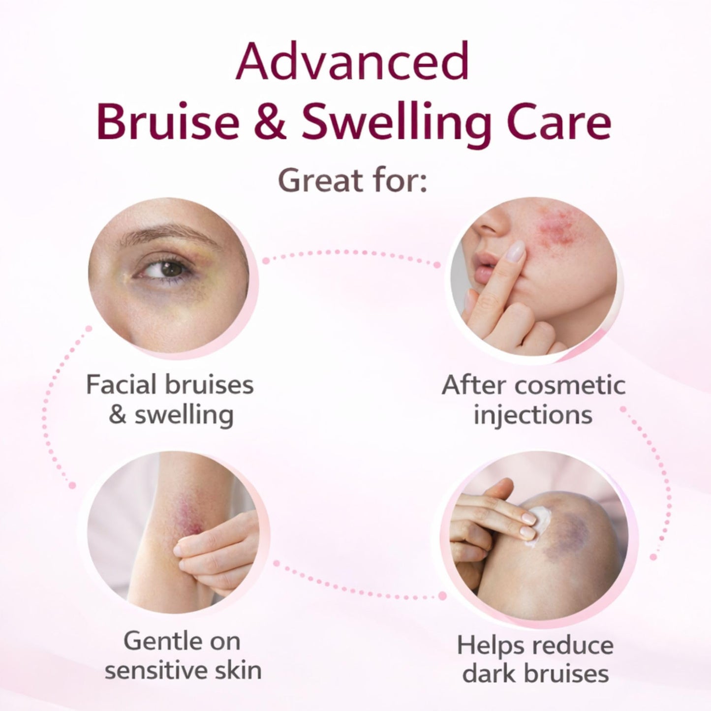 RMCYDS Bruise Cream with Vitamin K-Moisturizing & Firming Formula for Arms, Legs & Hands-Restores Fragile Skin with Anti-Wrinkle Benefits-4.23 oz