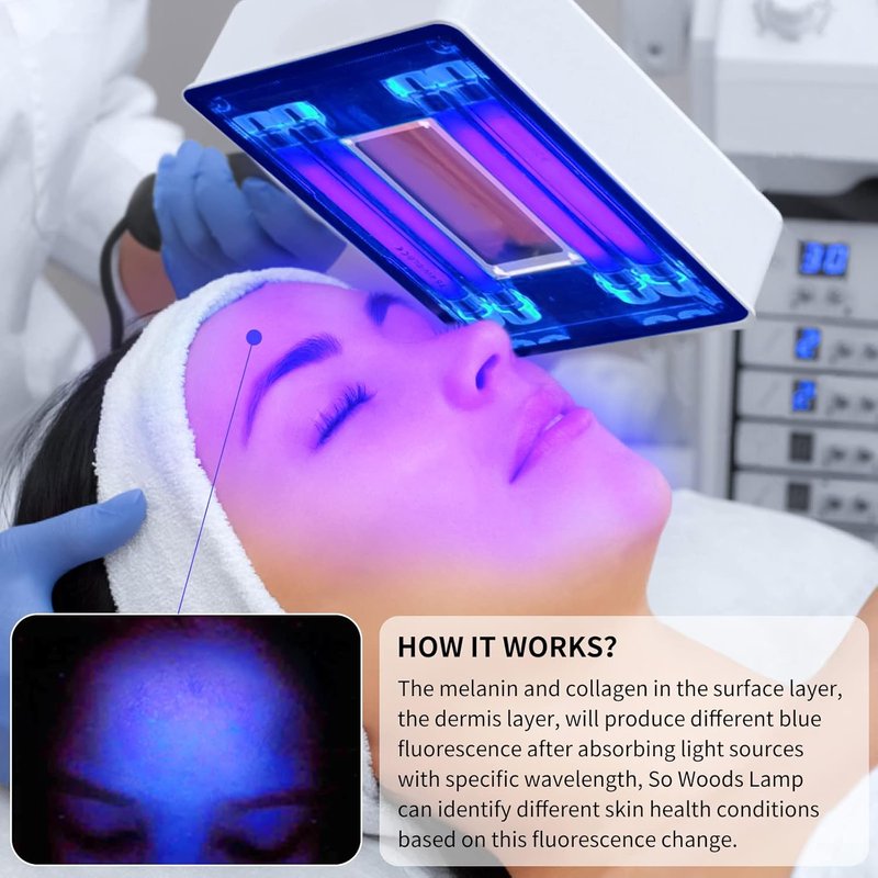Portable Facial Skin Analyzer - Woods Lamp for Home Use | Spa Quality Skin Care Tool