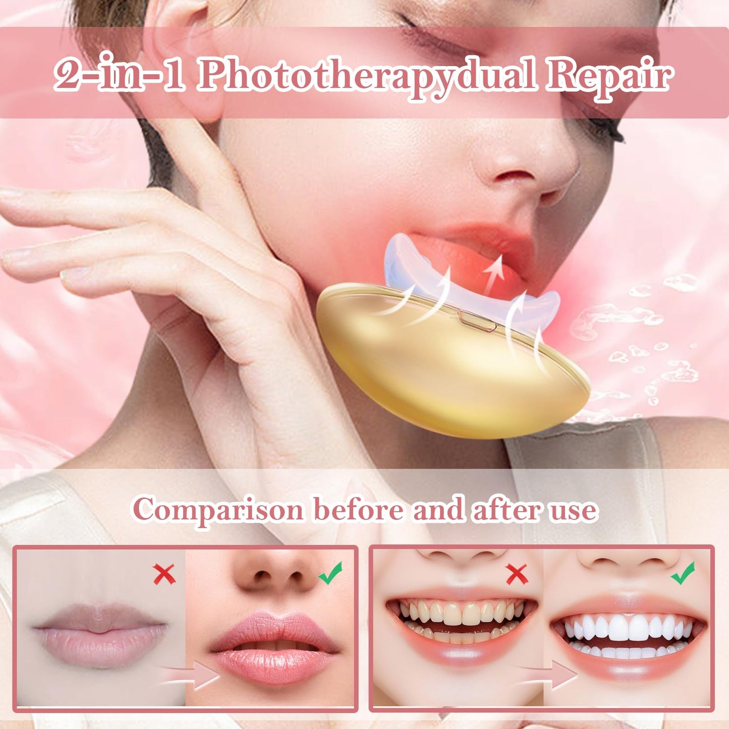 Lip Plumper Device - 2 in 1 Lip and Teeth Brighten Reduce Lip Wrinkles Lip Quick Lip Plumper for Women Female (Gold)