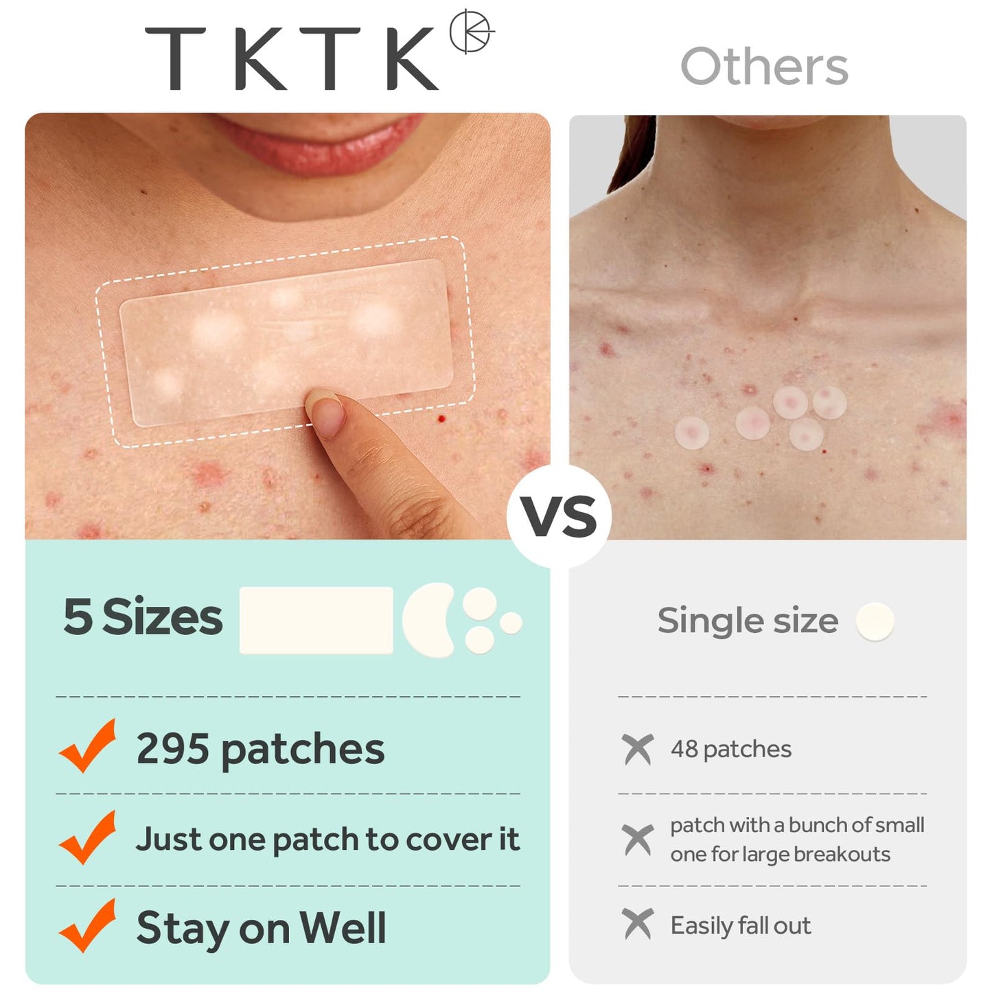 TKTK Large Pimple Patches for Face, 68 x 27 mm XL Hydrocolloid Bandages, Big Acne Patches for Body, Forehead, Chin, Nose, Chest and Back Blemish Zit Breakouts (Strip, Contoured, Dot 5 Sizes 295 Count)