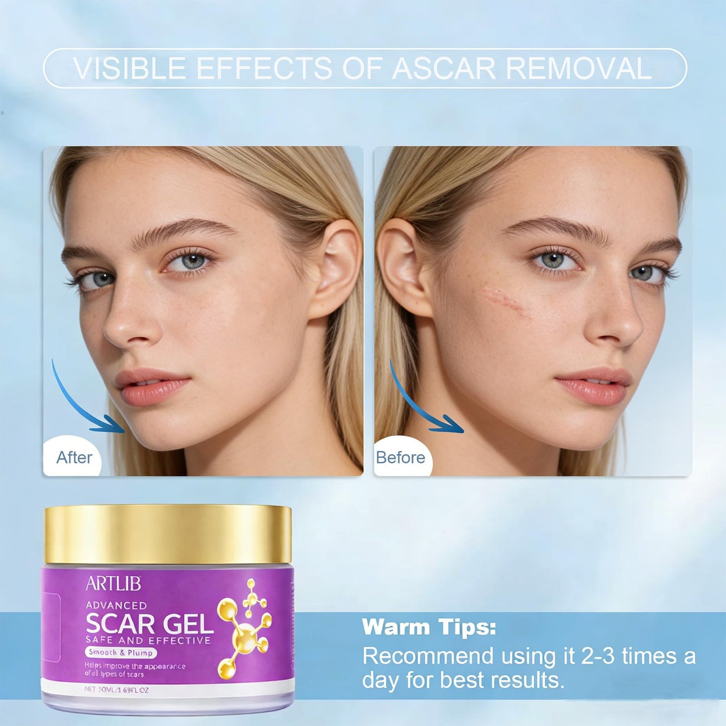 Scar Cream,Silicone Scar Gel,Helps Reduce Surgical Scars,Acne,Burn,Keloids Bump,Stretch Marks, Advanced Scar Removal Cream for Old and New Scars(1.69oz)