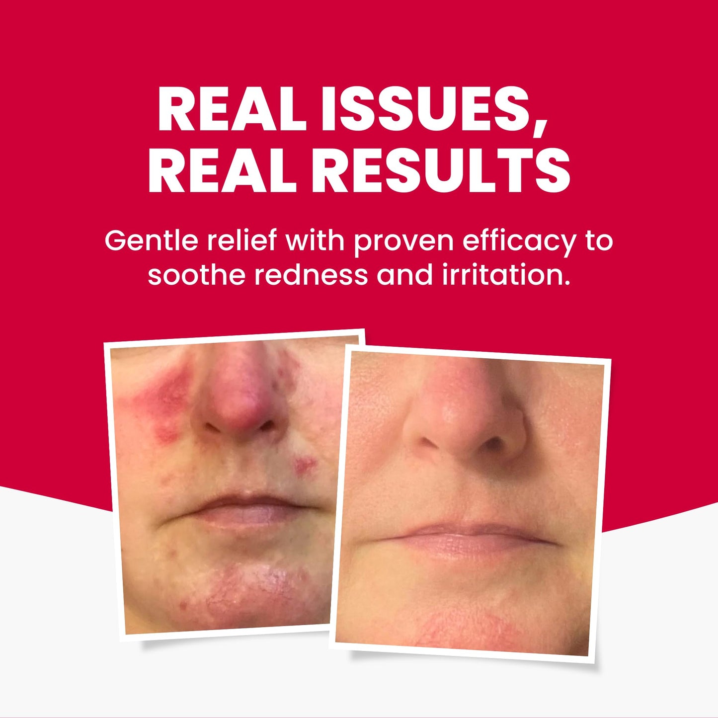 Grahams Natural Anti-Redness Face Wash for Rosacea – Gentle Facial Cleanser to Soothe and Calm Redness-Prone Skin With Green Tea, Aloe Vera and Cucumber | For Sensitive Skin (1 x 4.23 fl oz)