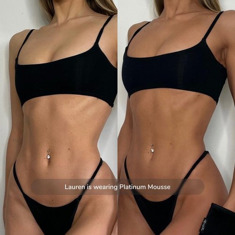 Loving Tan Platinum Mousse, Dark - Streak Free, Natural Looking, Professional Strength Sunless Tanner - 10+ Self Tan Applications per Bottle, Cruelty Free, Naturally Derived DHA - 6.7 Fl Oz
