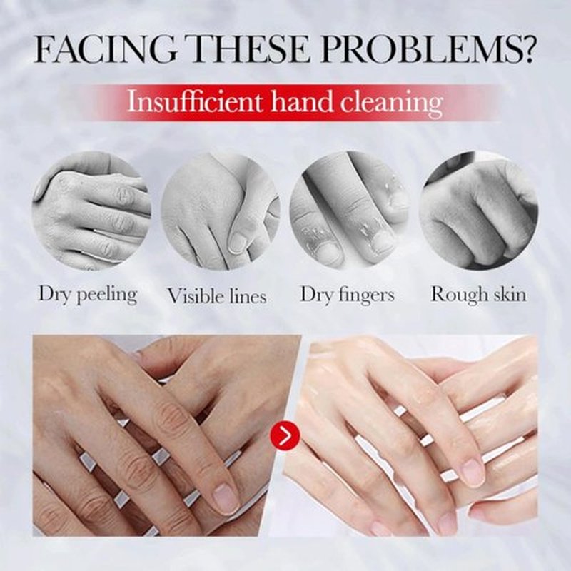 Sadoer Kojic Acid Hand Cream,Kojic Acid Hand Cream,Sadoer Kojic Acid Cream,Kojic Acid Face Cream (Hand+Face Cream, 30g)