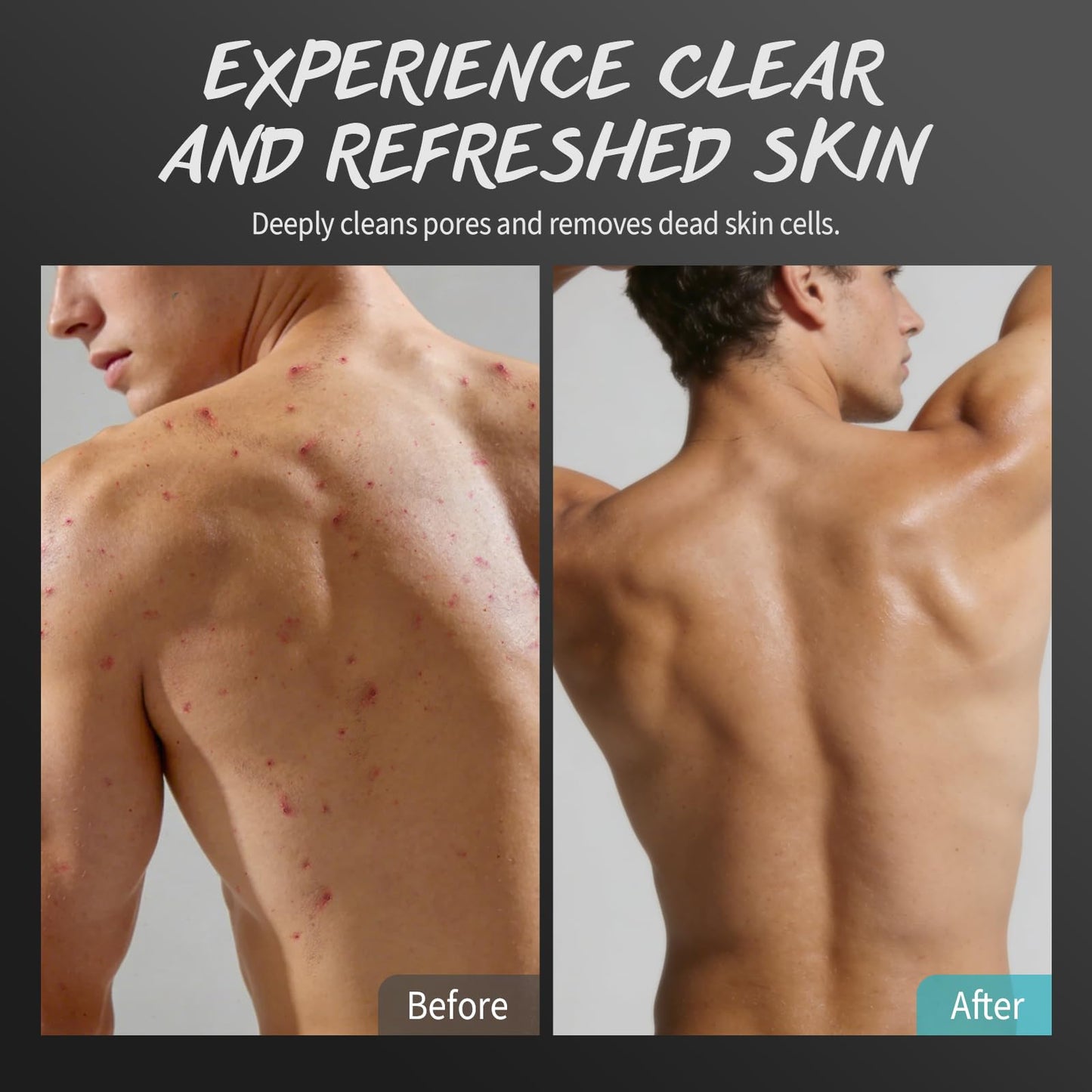 Men Body Scrub with Tea Tree Oil Exfoliating Body Scrub for Men Improve Odor Smooth Rough Skin Body Exfoliator Scrub for Back Chest Shoulders Butt Legs Mens Exfoliating Body Wash with 2% BHA 10% AHA