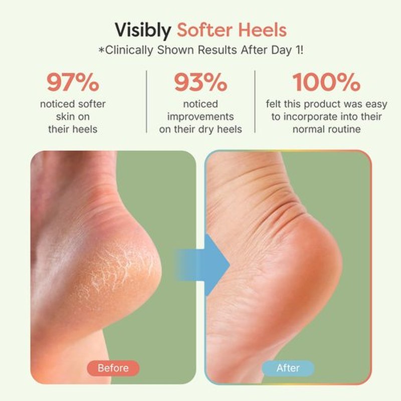 ZenToes Moisturizing Sleep Socks with Vitamin E, Olive Oil and Jojoba Seed Oil to Soften and Hydrate Dry Cracked Heels (Fuzzy Mint Green, Regular)