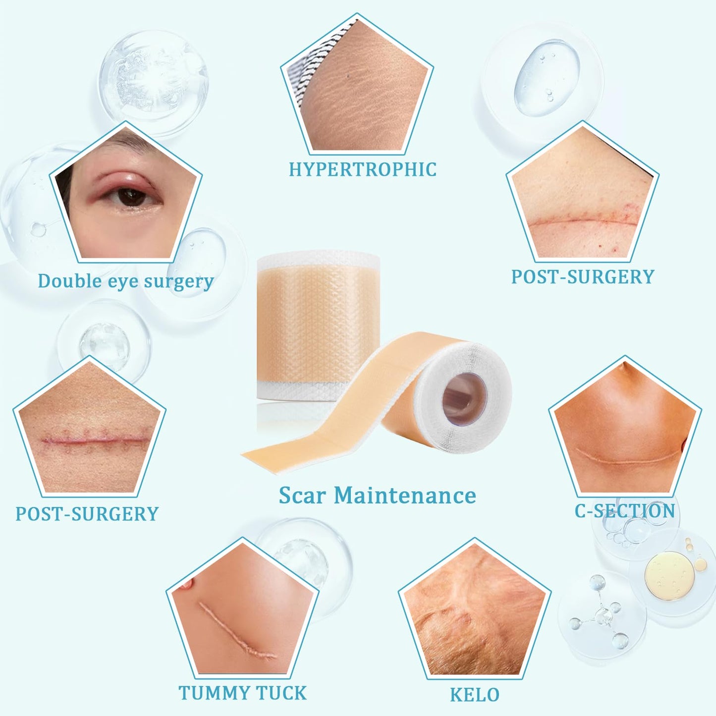 Silicone Scar Sheets, Self-Adhesive Scar Tape, Silicone Sheets For Scars, Scar Tape For Surgical Scars, Keloid Bump Removal, Cesarean Surgery Scar Removal(1.6"x 118" Roll)