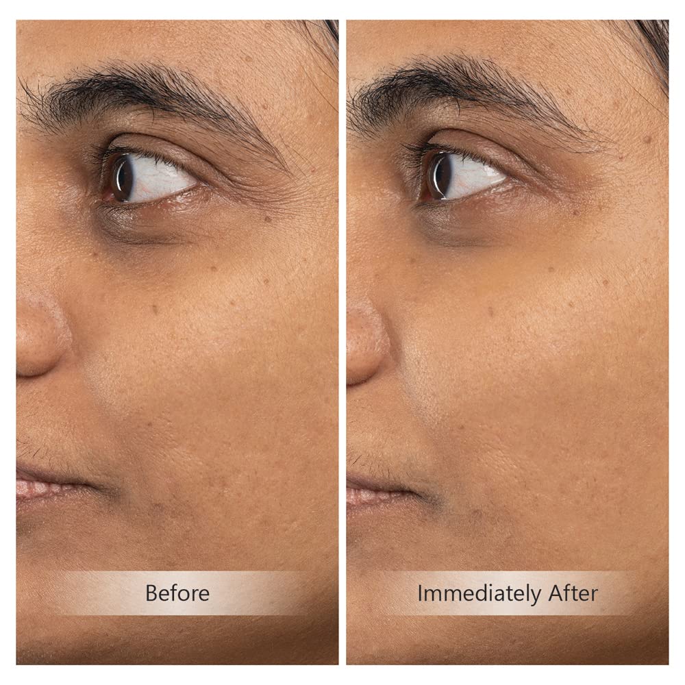 Youth Activating Instant Filler