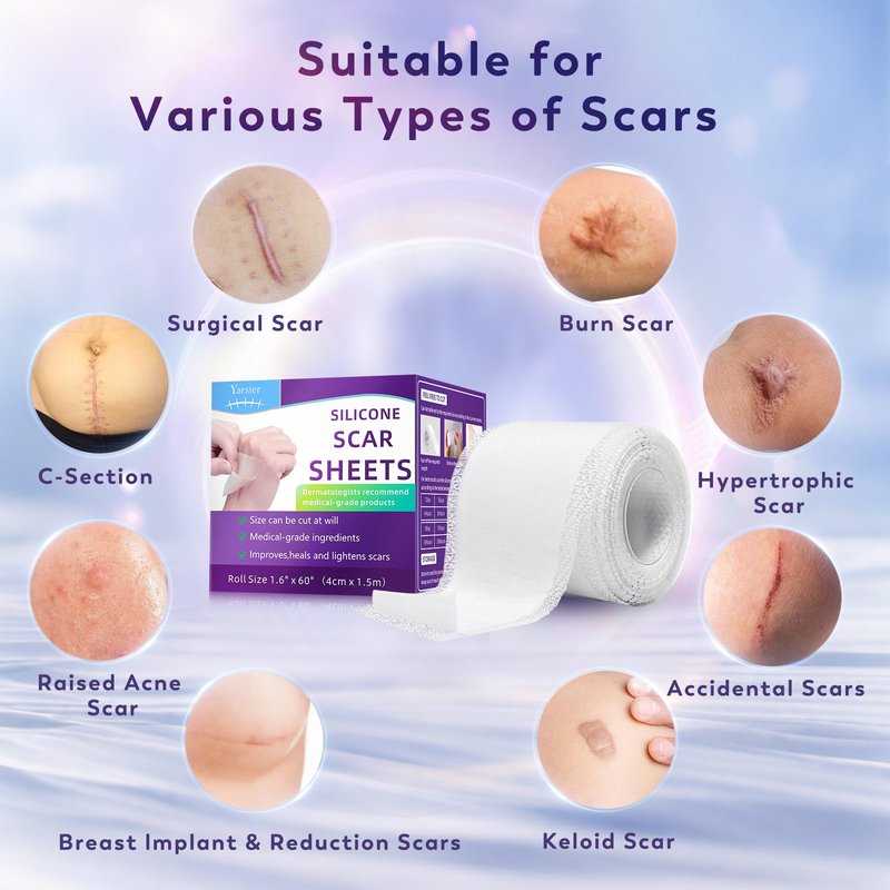 Yarster 100% Medical Grade Silicone Scar Sheets, Silicone Scar Tape(1.8"x 157" Roll-4M), Scar Tape for Surgical Scars, Burn, C-Section, Keloid Scars, Acne Treatment - Reusable