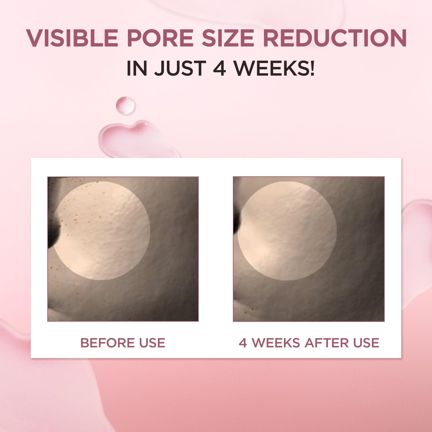 SKIN1004 Centella Poremizing Fresh Ampoule 1.69 fl.oz, 50ml, Korean Pink Serum for Enlarged Pores Minimizing with Madagascar Centella and Himalayan Pink Salt, Hydrating Facial Serum, Korean Skin Care