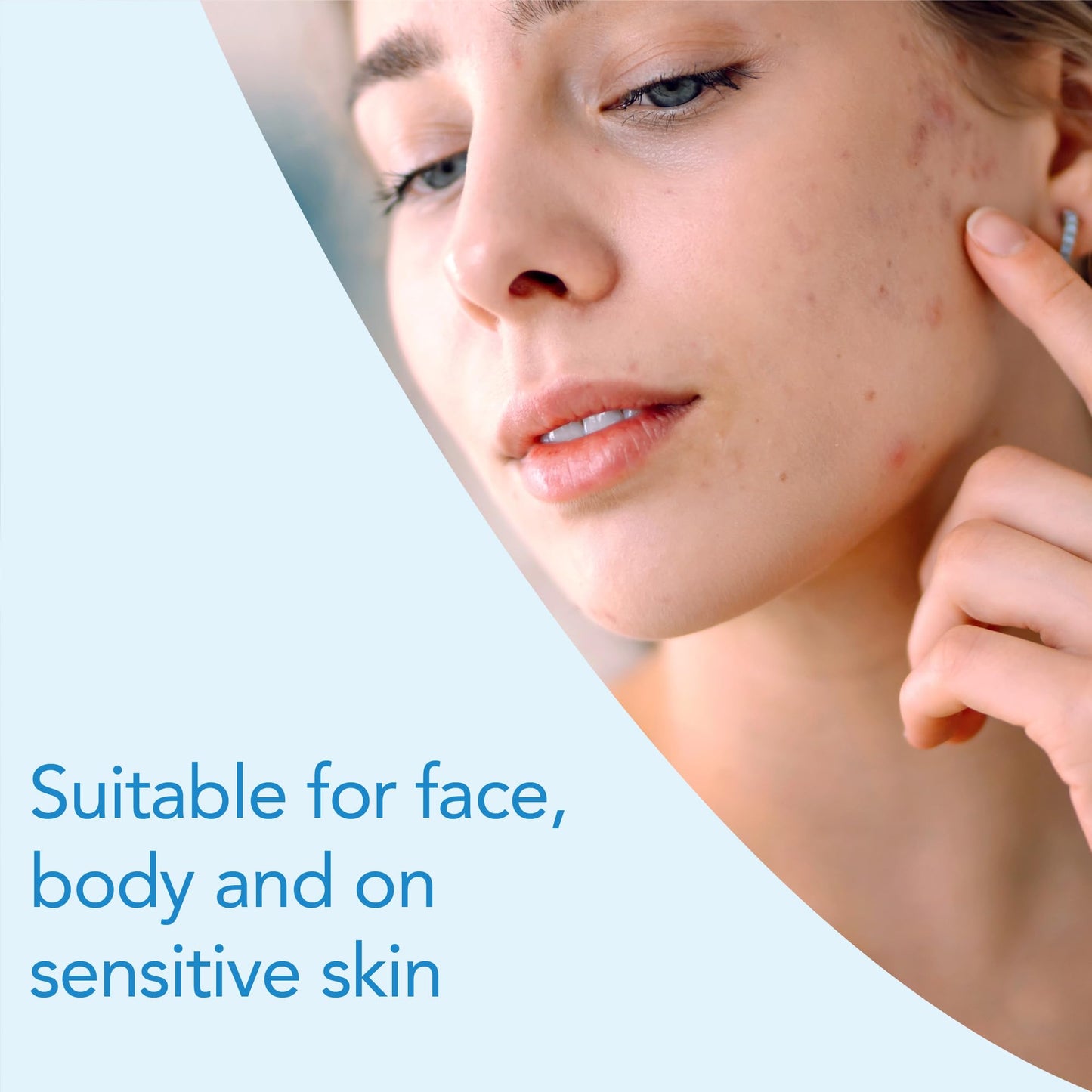 Kelo-Cote Gel for Scars 6g by Kelo-Cote