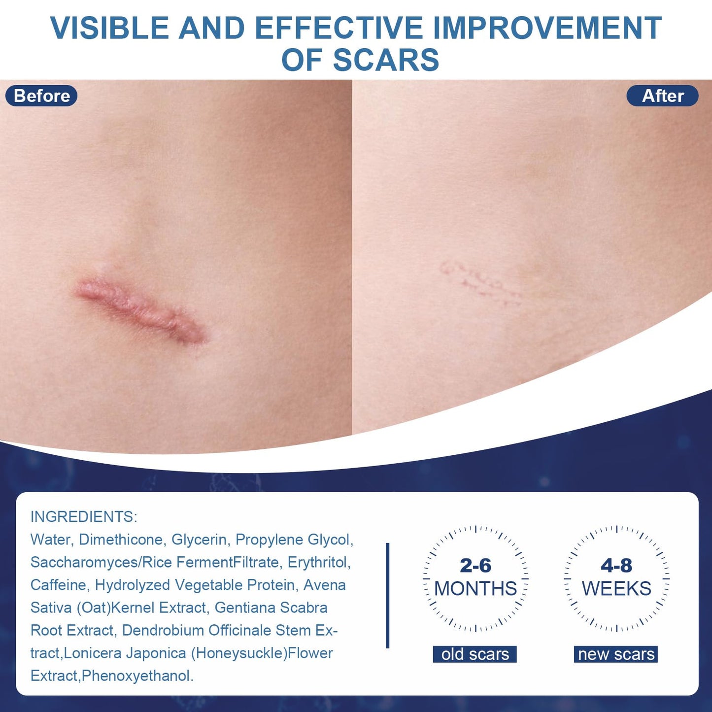 Scar Cream,Silicone Scar Gel,Helps Reduce Surgical Scars,Acne,Burn,Keloids Bump,Stretch Marks, Advanced Scar Removal Cream for Old and New Scars(1.69oz)