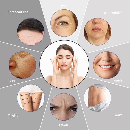 SOZOOM Pdo Threads for Eyes Lift, PDO Thread Eyes Fine Lines Under the Eyes Restore Skin's Firmness & Elasticity (20pcs-30G-38mm)