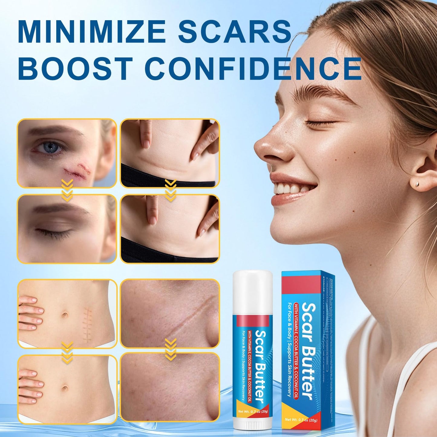 Scar Butter Stick for Scars, Cocoa Butter Stick with Vitamin E, Scars Repair Cream with 5 in 1 Smoothing Formula to Improves Texture & Discoloration, Non-Greasy
