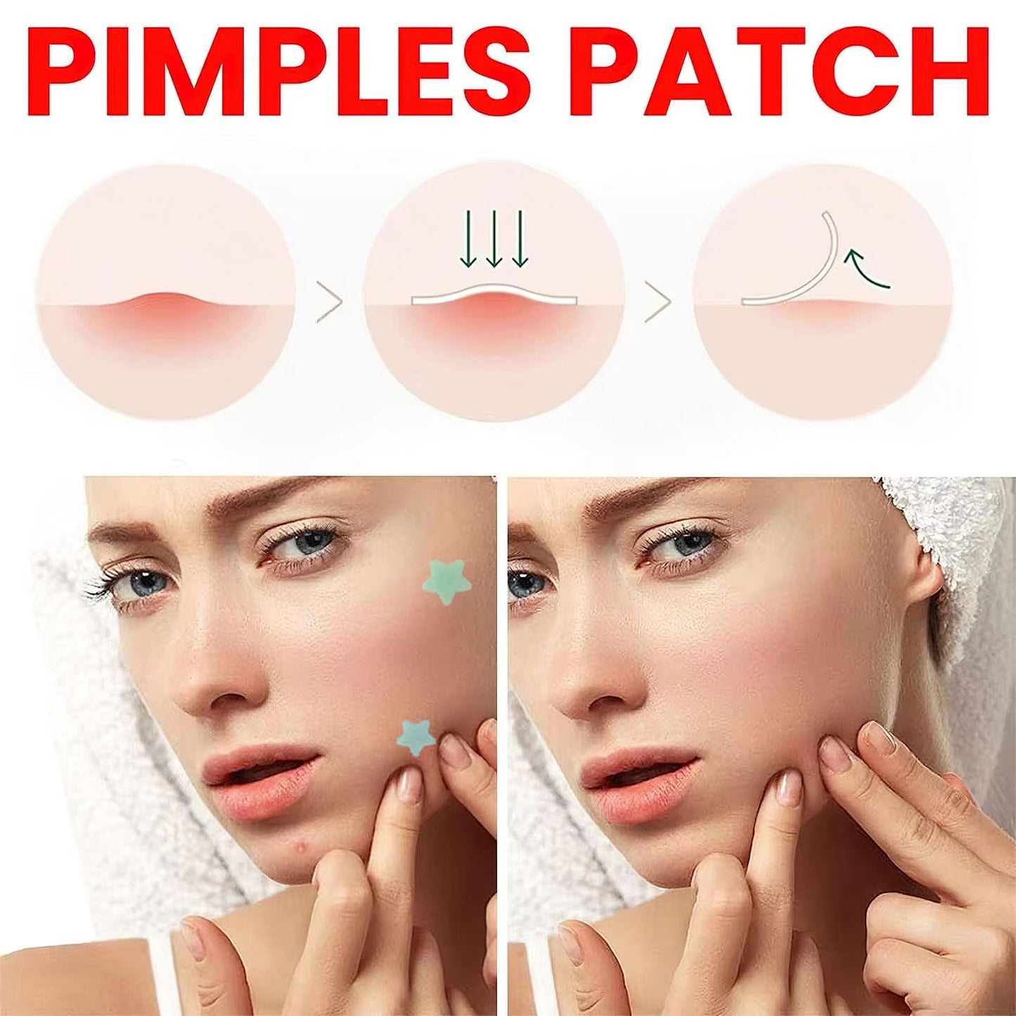 Pimple Patches for Face Cute Star Haydrocolloid Acne Patches Tea Tree oil Salicylic Acid Cica oil Colorful Invisinble Acne Removal Skin Care Stickers