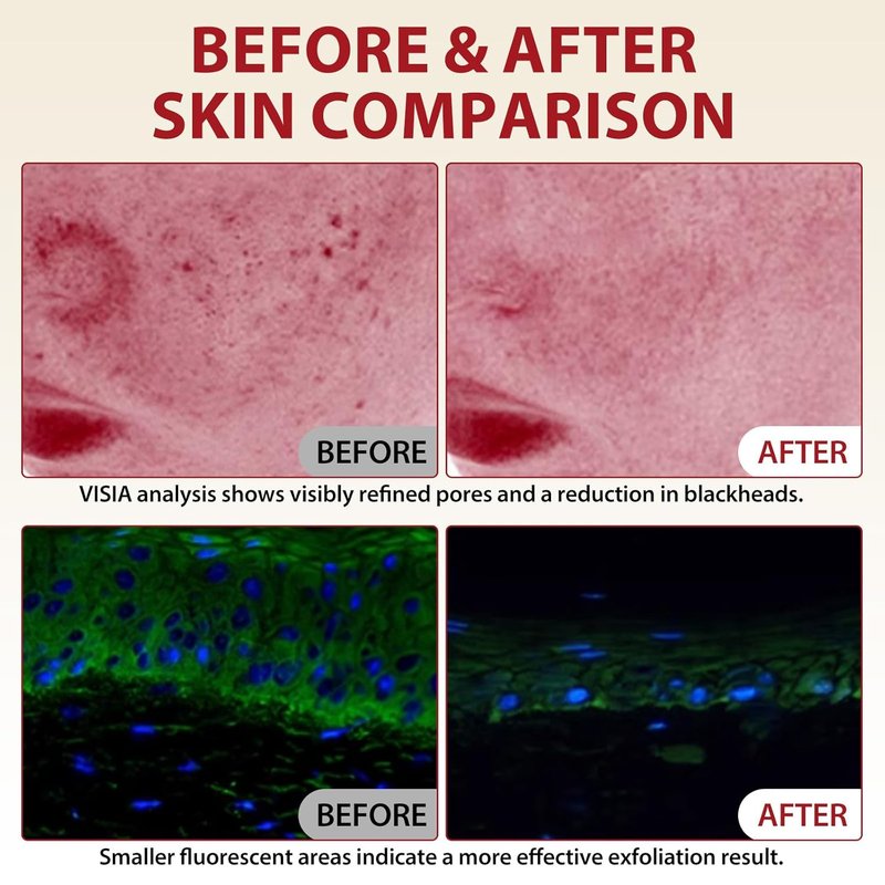 Peel Shot Glow Rice Ampoule Duo - Black & White Rice Exfoliant for All Skin Types | Moisturizing Pore Minimizer & Deep Hydration
